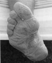 Fixing Your Feet